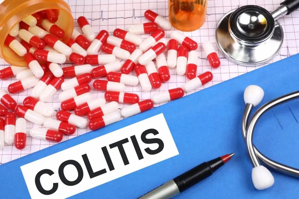 Colitis, Síntomas de colitis, Colitis ulcerosa, Colitis y estrés | gedyt gastroenterología análisis y terapéutica