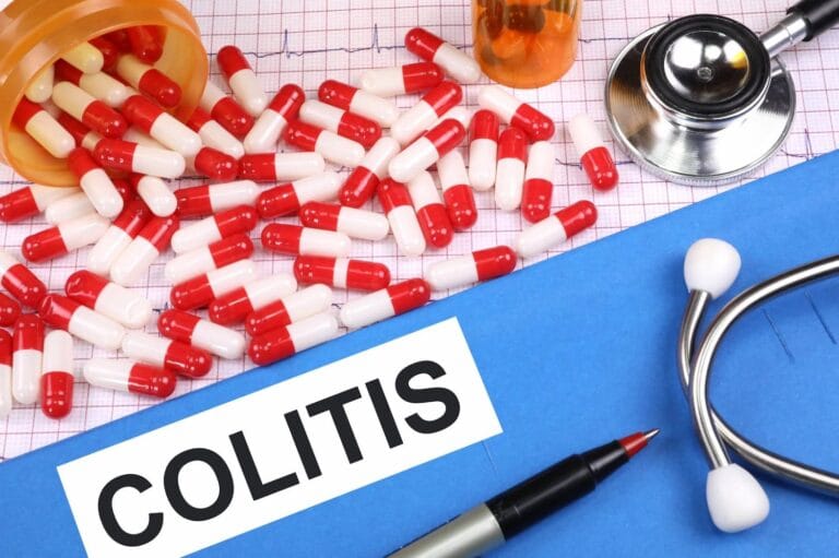 Colitis, Síntomas de colitis, Colitis ulcerosa, Colitis y estrés | gedyt gastroenterología análisis y terapéutica