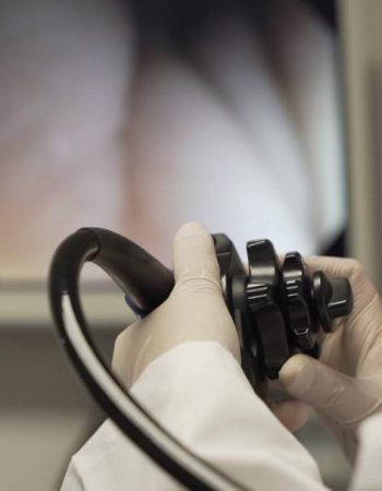 endoscopia-alta endoscopia-alta
